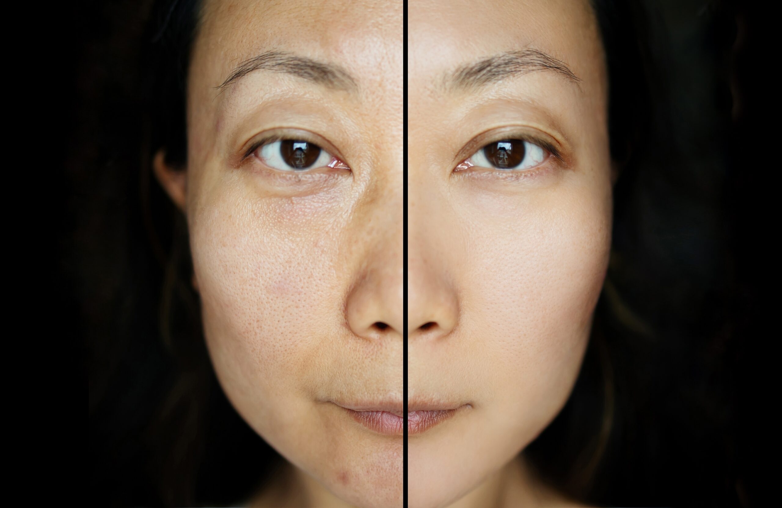 Split face before and after