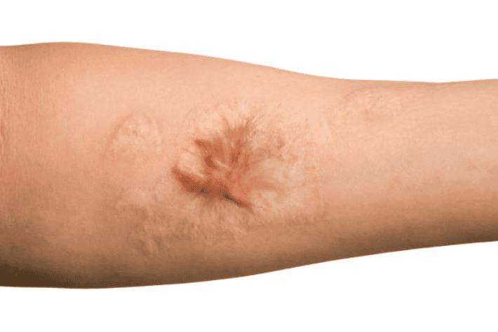 The Scars of the Job: Expert Care for Work-Related Injuries and Workers’ Comp